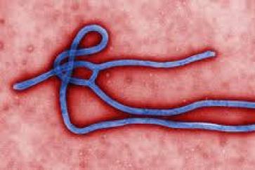 Co se děje v těle, když onemocní ebolou?